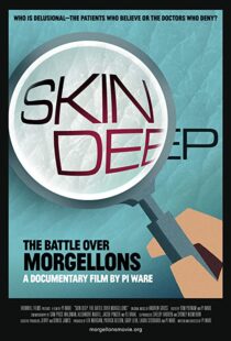 دانلود مستند Skin Deep: The Battle Over Morgellons 2019104233-227405337